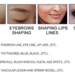 pico laser tattoo removal machines