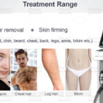 hair removal diode laser