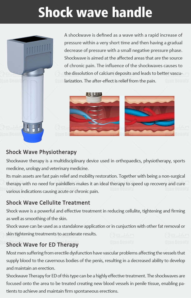 extracorporeal shockwave lithotripsy