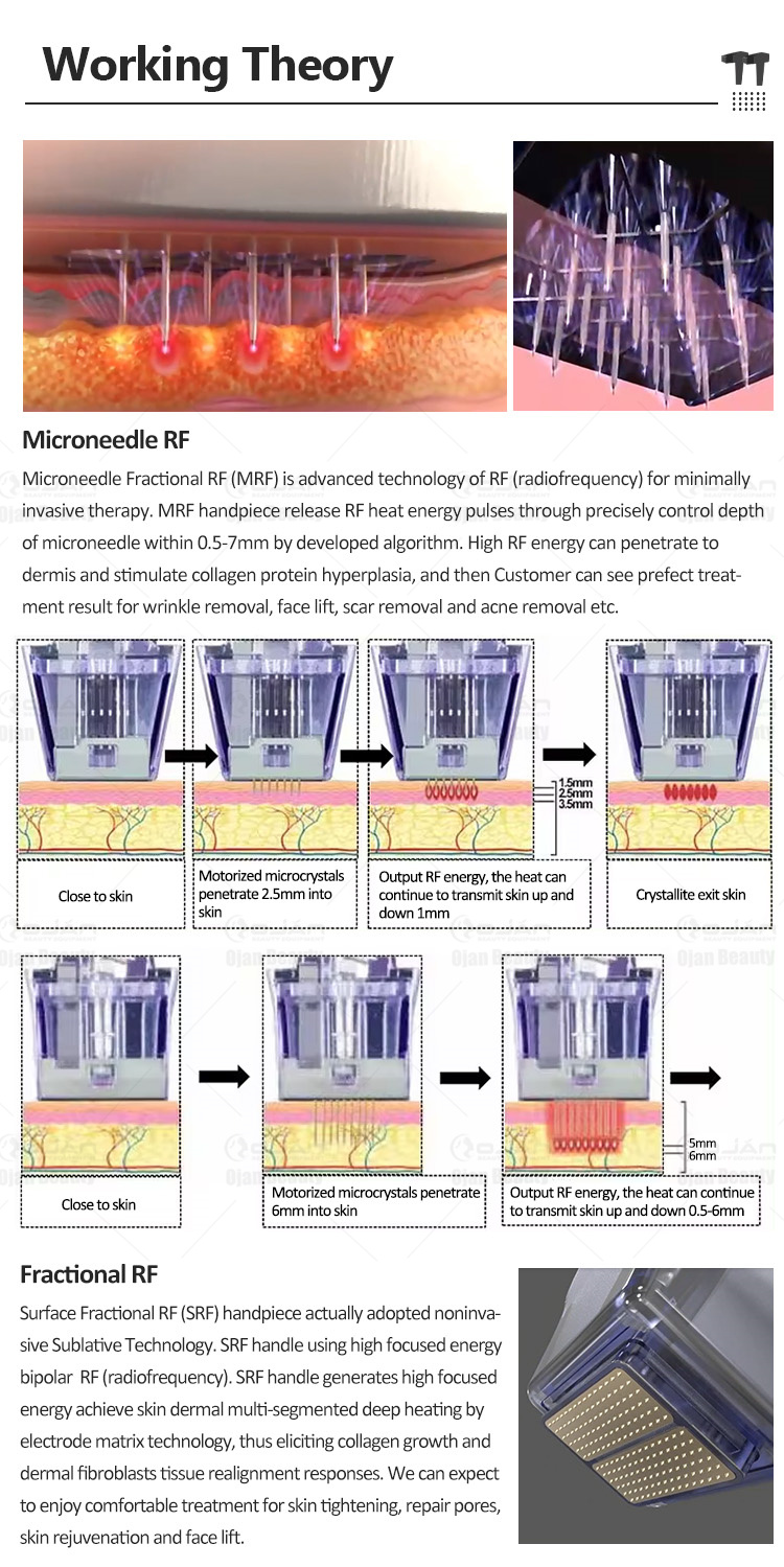  rf skin machine