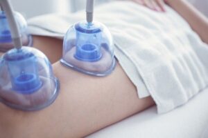 Understanding Vacuum Therapy for Buttocks