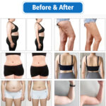 Before & After Results Of 10D Maxlipo Master Laser Pro & EMS Cryo Plate Weight Loss Machine