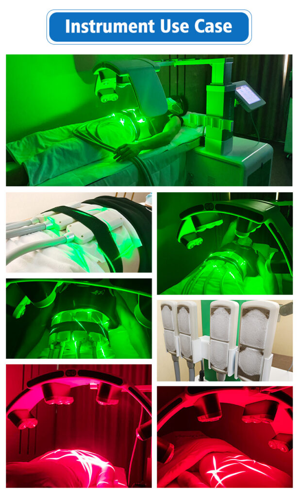 Instrument Use Case Of 10D Maxlipo Master Laser Pro & EMS Cryo Plate Weight Loss Machine
