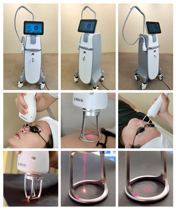 Professional Machines That Deliver Fractional CO2 Results