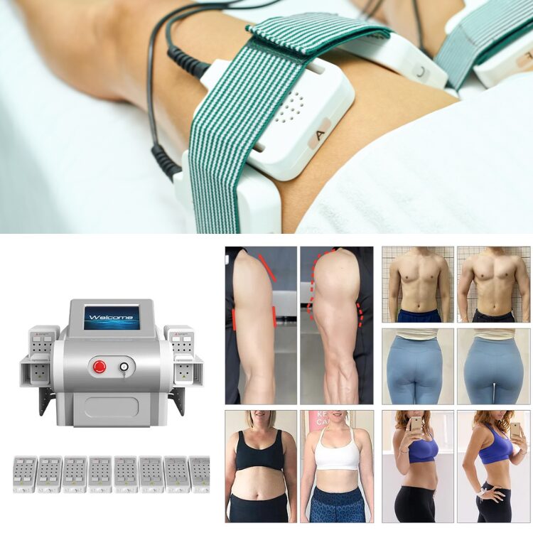 Laser Lipo Before And After — Real Results, Treatment Benefits & The Best Machines To Use