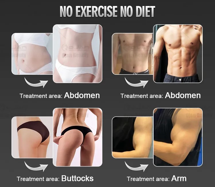 Body Areas That Can Be Treated
