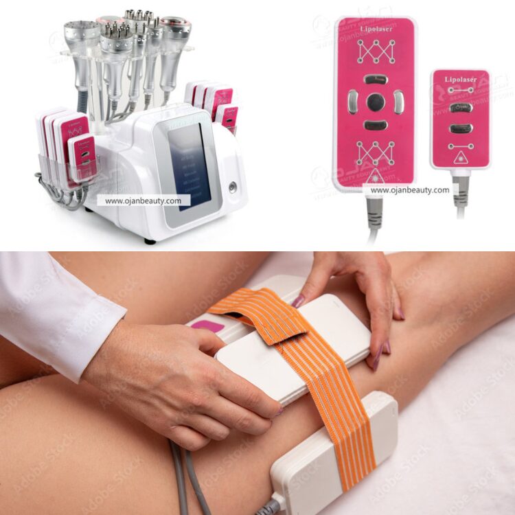 Lipolaser: The Proven Non-Surgical Fat Reduction Solution In 2026