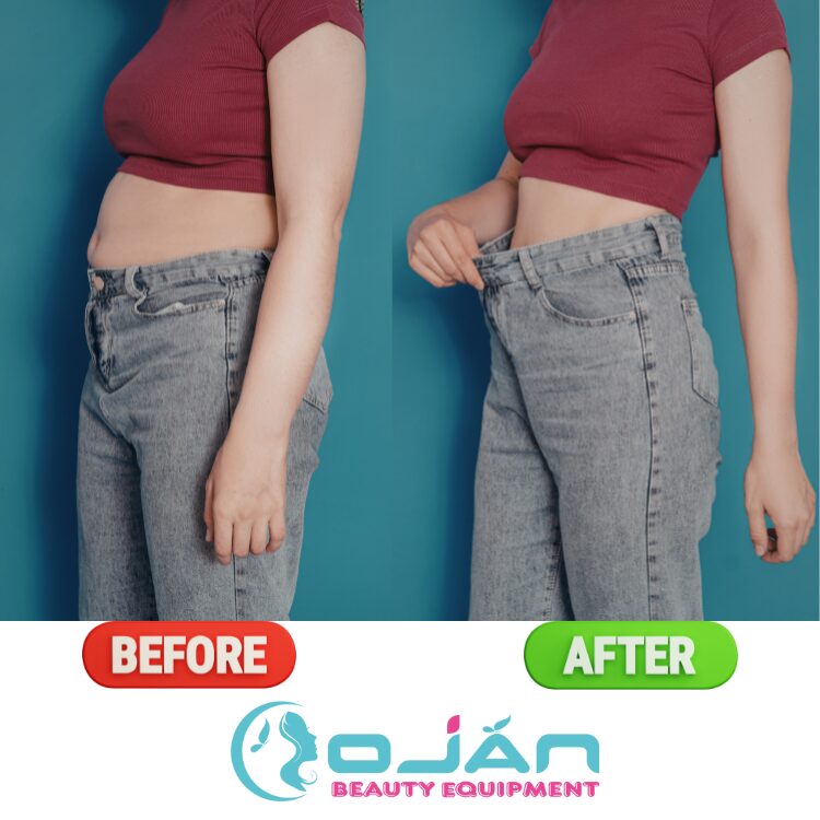 Body Contouring Before And After: Real Results, Expectations, & Expert Insights (2026 Guide)