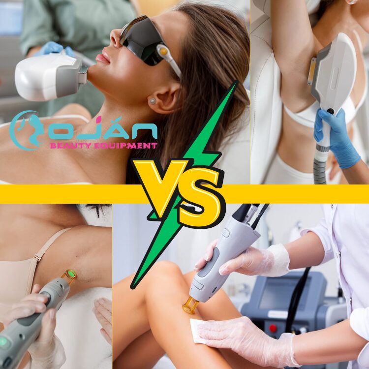 IPL Vs Laser Hair Removal: The Ultimate 2026 Expert Comparison Guide