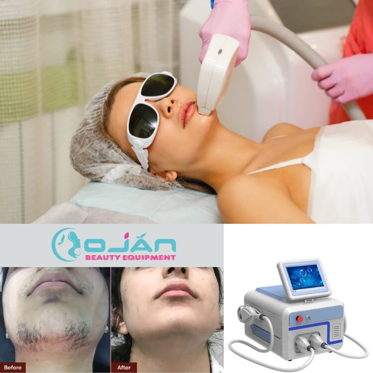 Chin Laser Hair Removal: Complete Guide To Smooth, Hair-Free Skin