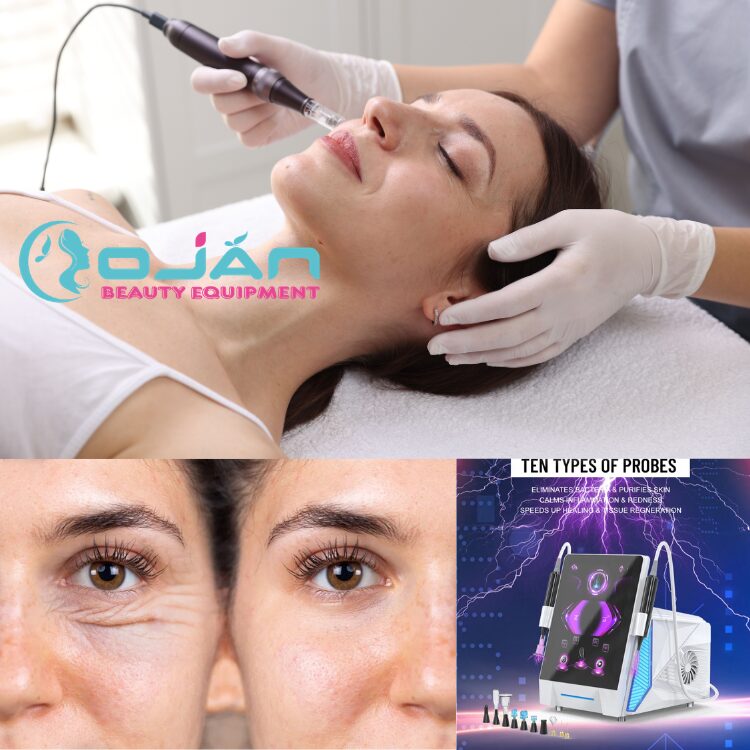 Plasma Pen Treatment: Powerful Benefits, Risks & Expert Insights (2026 Guide)